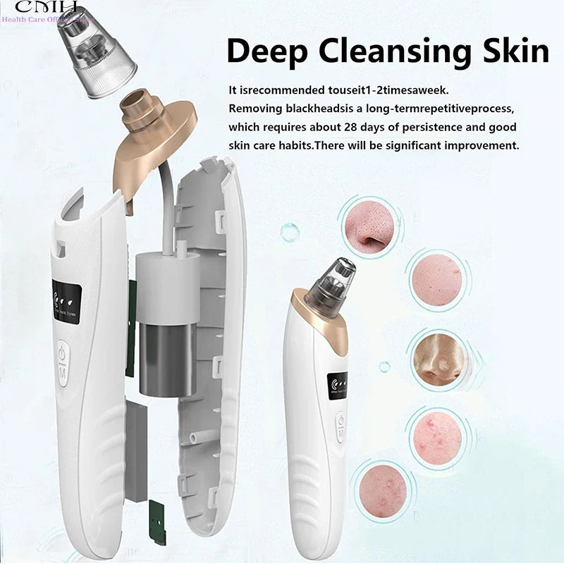 Blackhead Vacuum and Pore Cleaner