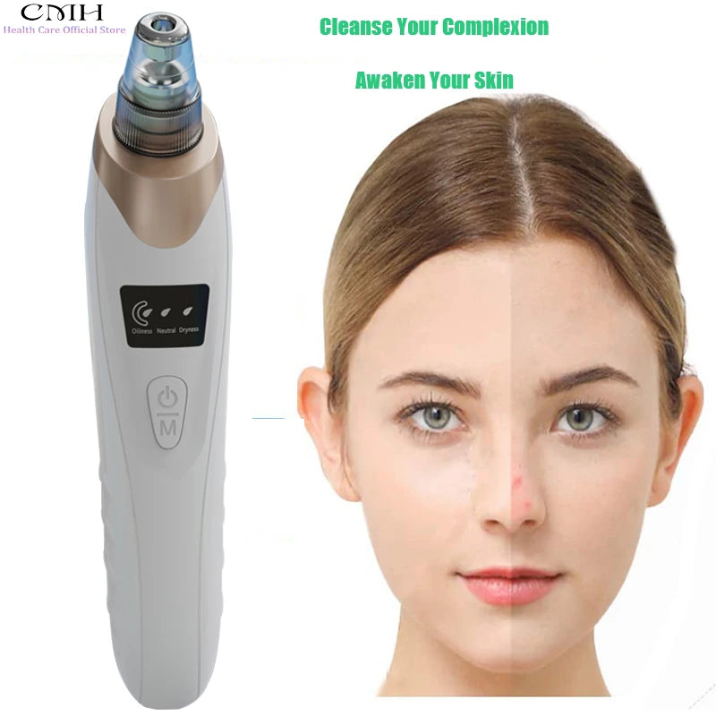 Blackhead Vacuum and Pore Cleaner
